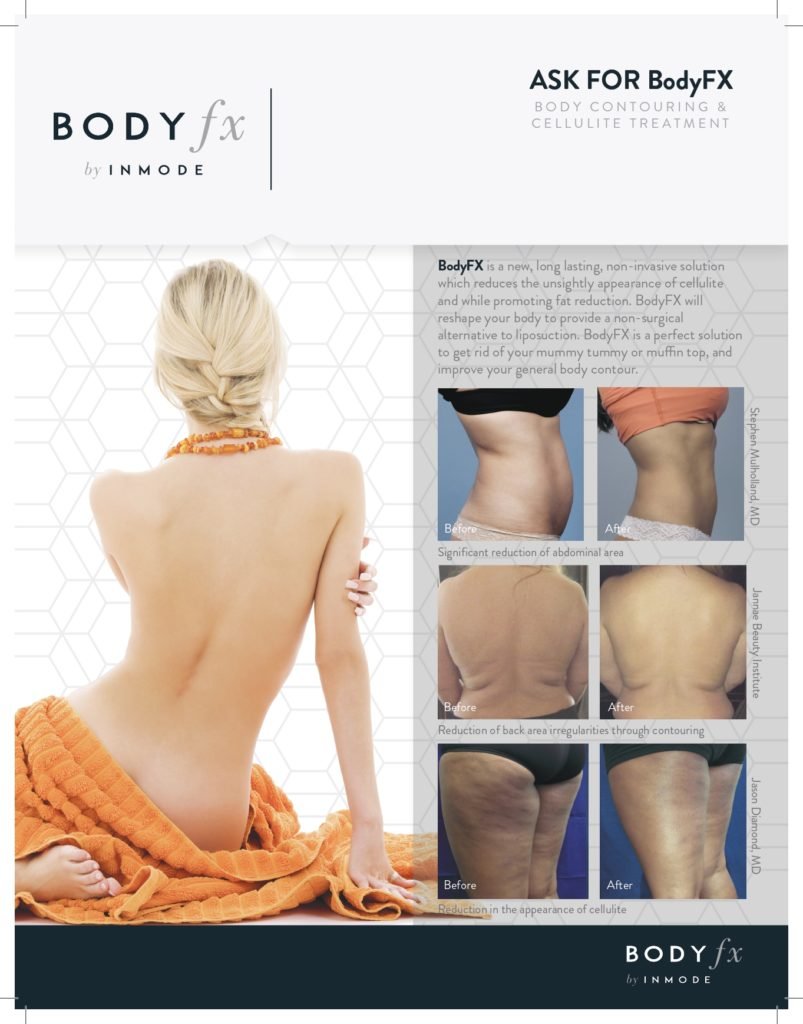 Woman before and after body contouring.