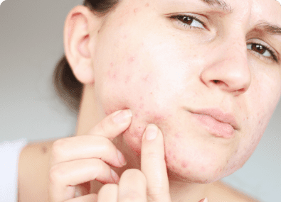 New Age Laser Clinic | Medical Spa & Laser Clinic|Laser Acne Treatment Oakville