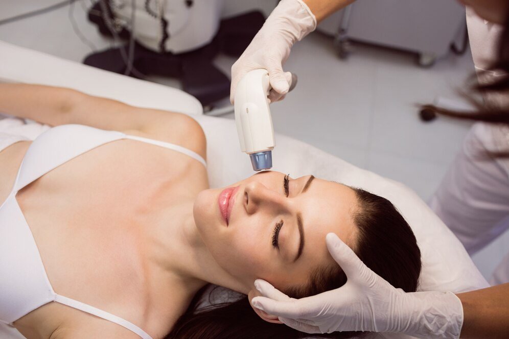 Top Myths About Face Laser Acne Treatment Debunked by Experts at New Age Laser