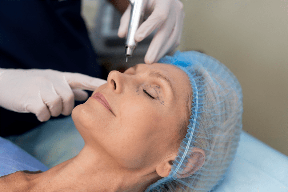Top 5 Benefits of Laser Skin Resurfacing for Aging Skin