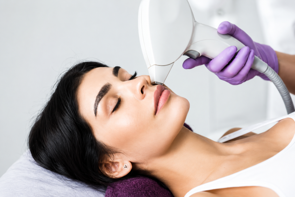 Frac3 Laser Hair Removal