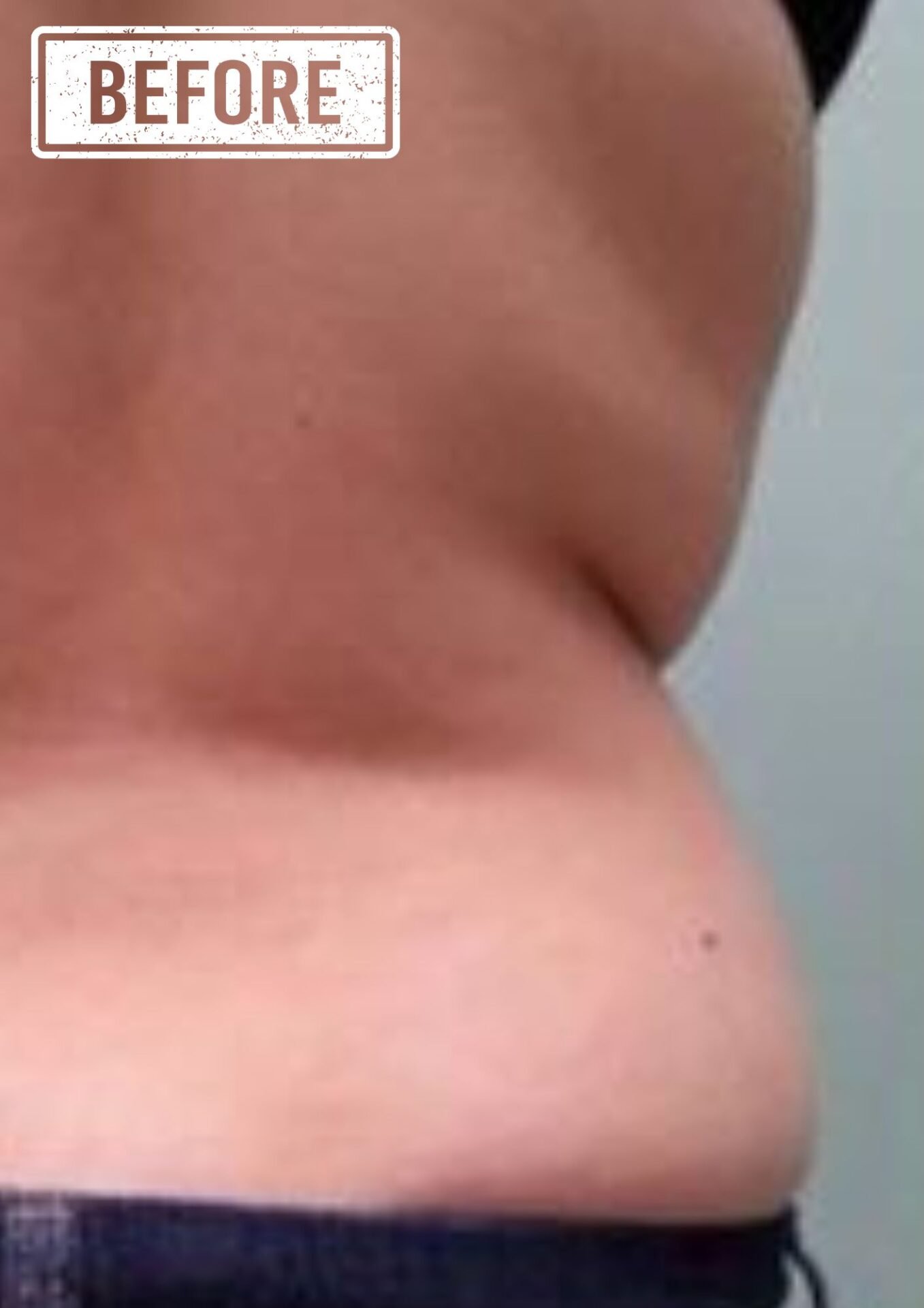 New Age Laser Clinic | Medical Spa & Laser Clinic | Body Contouring in Kitchener