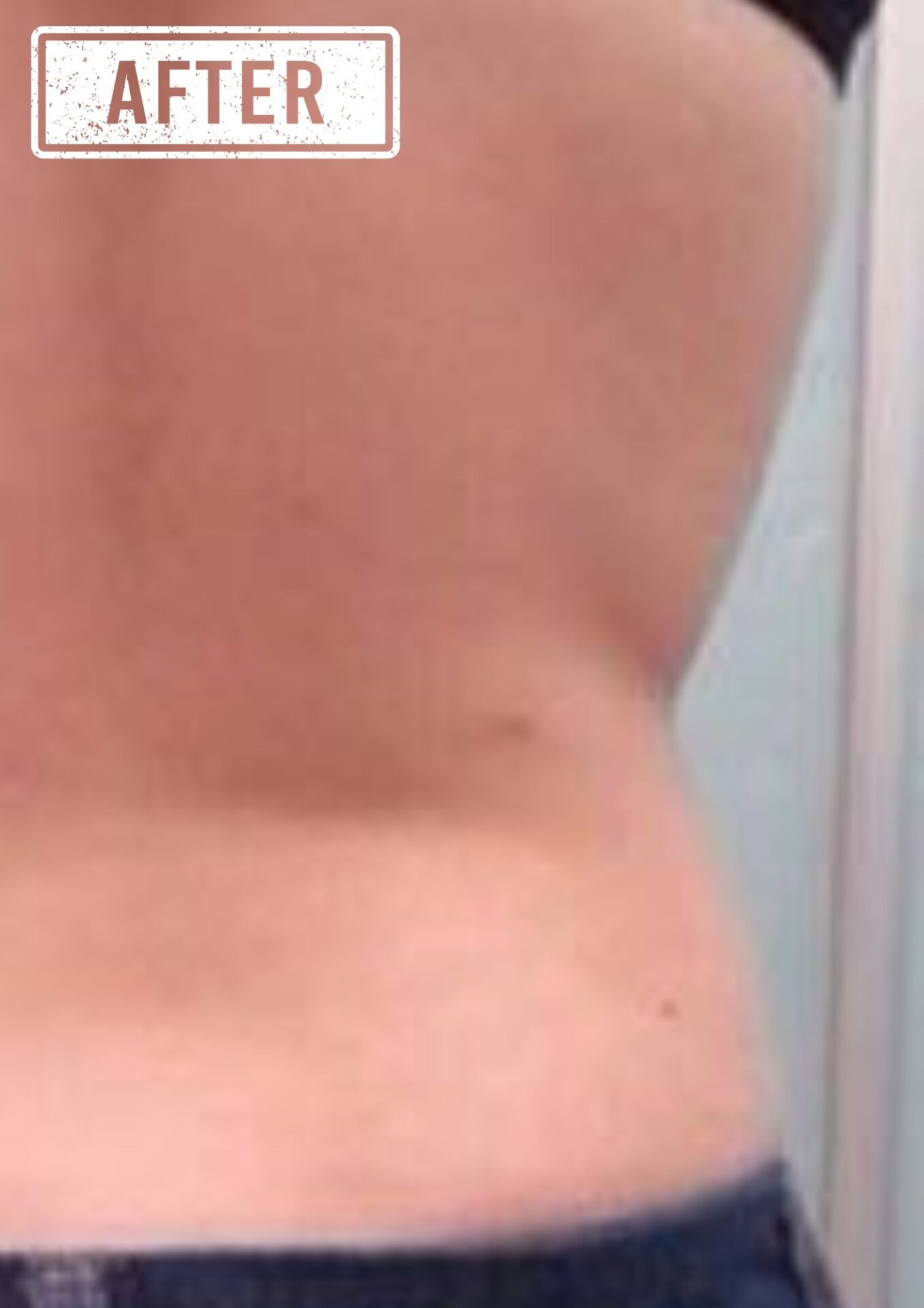 New Age Laser Clinic | Medical Spa & Laser Clinic | Body Contouring in Kitchener