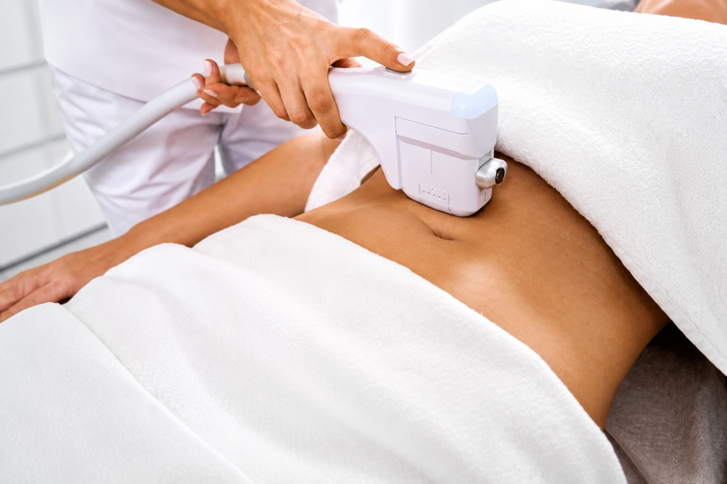 laser body sculpting