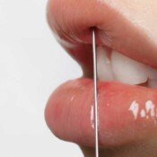 Botox & Fillers Injection