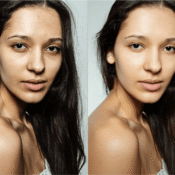 Before and after photo of a woman's skin.