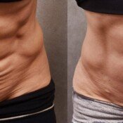 Forma Before & After