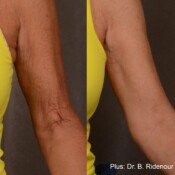 Forma Before & After