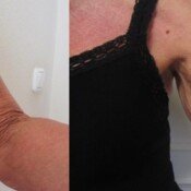 Forma Before & After