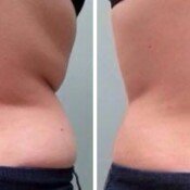 Side-by-side comparison of before and after.